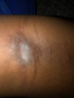 Eczema Cream " Heal me up Butter"